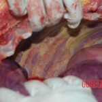 Autopsy of Chinese female