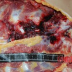 Autopsy of Chinese female