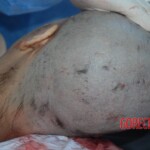 Autopsy of Chinese female