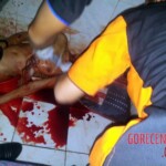 Prostitute with throat slit