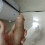 A man with a cut off penis