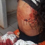 Stabbed woman in morgue