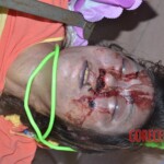 Strangled raped woman with cut nipple