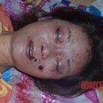 Strangled raped woman with cut nipple