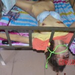 Strangled raped woman with cut nipple