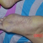 Strangled raped woman with cut nipple