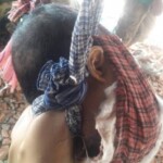 Hanged teenager with tumor