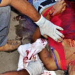 Stabbed girl to death