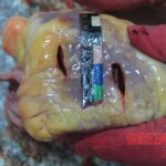 Stabbed and slashed girl