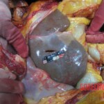 Stabbed and slashed girl