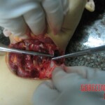 Stabbed and slashed girl