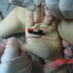 Stabbed and slashed girl