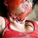 Throat slit woman