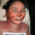 Dead woman in morgue