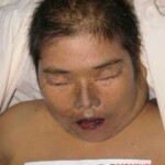 Dead woman in morgue