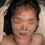 Dead woman in morgue