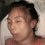 Dead woman in morgue