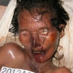 Dead woman in morgue