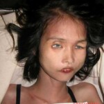 Dead woman in morgue