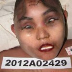 Dead woman in morgue