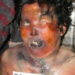 Dead woman in morgue