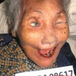 Dead woman in morgue