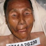 Dead woman in morgue