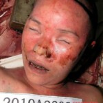 Dead woman in morgue