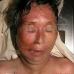 Dead woman in morgue