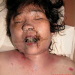 Dead woman in morgue