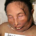 Dead woman in morgue