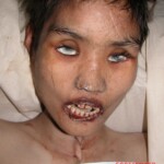 Dead woman in morgue