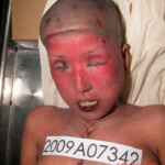 Dead woman in morgue