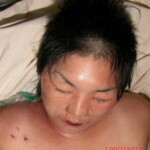 Dead woman in morgue