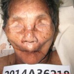 Dead woman in morgue