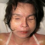 Dead woman in morgue