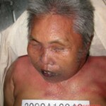 Dead woman in morgue