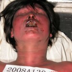 Dead woman in morgue