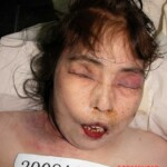 Dead woman in morgue