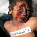 Dead woman in morgue