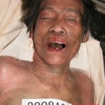 Dead woman in morgue