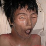 Dead woman in morgue