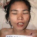 Dead woman in morgue