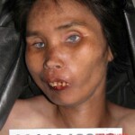 Dead woman in morgue