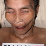 Dead woman in morgue