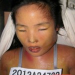 Dead woman in morgue