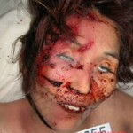 Dead woman in morgue