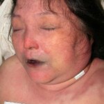 Dead woman in morgue