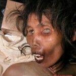 Dead woman in morgue