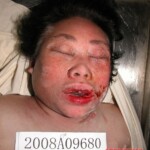 Dead woman in morgue